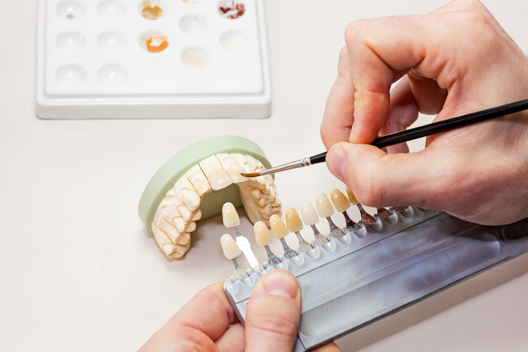 Restorative Dentistry Rockville MD Dental Implants